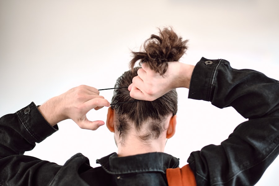 Photo Hair Fall Reasons