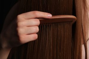 Photo Receding Hairline Stages