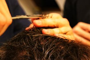 Photo Itchy Scalp Problems