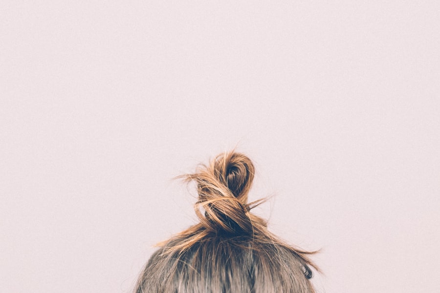 Unhealthy Scalp Men Ignore