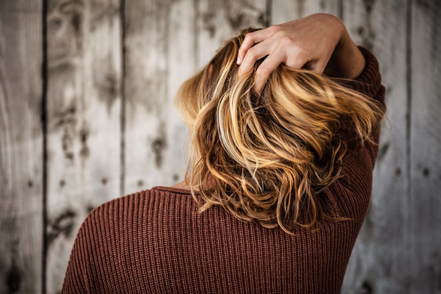 Photo Hair Loss
