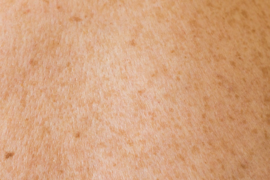 Photo Clear Skin