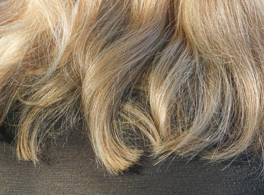 Photo Hair Turns Grey Early
