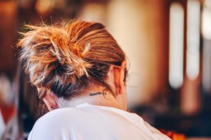 Photo Unhealthy Scalp Men Ignore