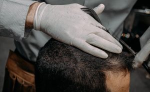 Photo Itchy Scalp Problems