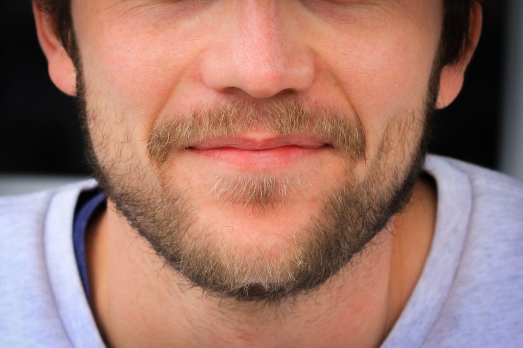 Photo Patchy Beard Causes