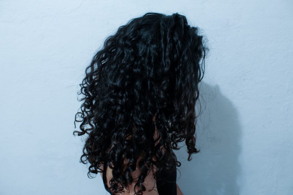 Photo Hair Loss