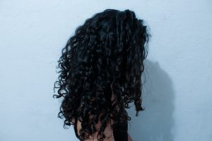 Photo Hair Loss