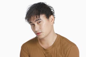 Photo Hair Loss Due to Poor Diet